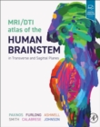 Image for MRI/DTI atlas of the human brainstem in transverse and sagittal planes
