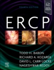Image for ERCP
