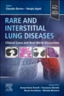 Image for Rare and Interstitial Lung Diseases : Clinical Cases and Real-World Discussions