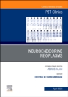 Image for Neuroendocrine neoplasms