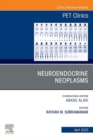 Image for Neuroendocrine Neoplasms