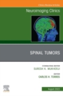 Image for Spinal Tumors