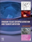 Image for Principles and practice of ovarian tissue cryopreservation and transplantation