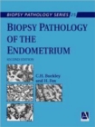 Image for Biopsy Pathology of the Endometrium, 2Ed
