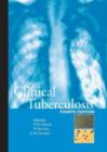 Image for Clinical tuberculosis