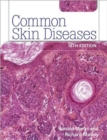 Image for Common Skin Diseases 18th edition