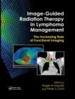 Image for Image-Guided Radiation Therapy in Lymphoma Management