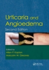 Image for Urticaria and Angioedema