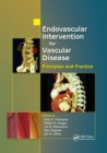 Image for Endovascular Intervention for Vascular Disease