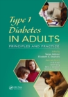Image for Type 1 Diabetes in Adults : Principles and Practice