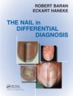 Image for Nail in Differential Diagnosis