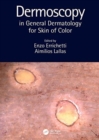 Image for Dermoscopy in General Dermatology for Skin of Color