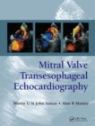 Image for Mitral Valve Transesophageal Echocardiography