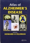 Image for Atlas of Alzheimer&#39;s disease
