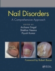 Image for Nail Disorders