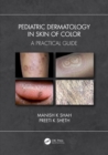 Image for Pediatric dermatology in skin of color  : a practical guide