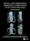 Image for Fetal and perinatal skeletal dysplasias  : an atlas of multimodality imaging