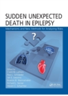 Image for Sudden Unexpected Death in Epilepsy