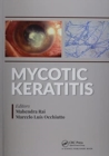 Image for Mycotic Keratitis