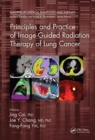 Image for Principles and practice of image-guided radiation therapy of lung cancer