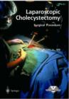 Image for Laparoscopic Cholecystectomy - Surgical Procedure