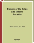 Image for Tumors of the fetus and infant: an atlas