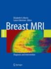 Image for Breast MRI: diagnosis and intervention