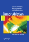 Image for Tumor ablation: principles and practice