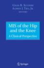 Image for MIS of the Hip and the Knee