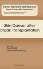 Image for Advances in cutaneous transplant oncology