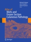 Image for Atlas of Mohs and frozen section cutaneous pathology