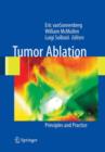 Image for Tumor Ablation : Principles and Practice