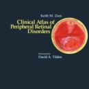 Image for Clinical Atlas of Peripheral Retinal Disorders