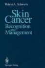 Image for Skin Cancer