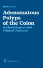 Image for Adenomatous Polyps of the Colon