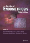 Image for Atlas of Endometriosis