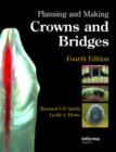 Image for Planning and Making Crowns and Bridges