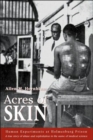 Image for Acres of skin  : human experiments at Holmesburg Prison