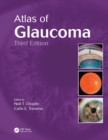 Image for Atlas of Glaucoma