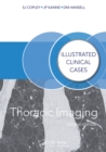 Image for Thoracic Imaging: Illustrated Clinical Cases, Second Edition