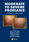 Image for Moderate to Severe Psoriasis