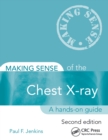 Image for Making Sense of the Chest X-ray: A Hands-on Guide