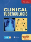 Image for Clinical Tuberculosis.