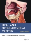 Image for Oral and oropharyngeal cancer