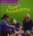Image for Down syndrome