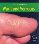 Image for Warts and Verrucas