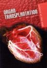 Image for Organ transplantation