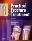 Image for Practical Fracture Treatment