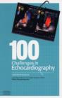Image for 100 Challenges in Echocardiography