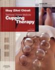 Image for Traditional Chinese medicine cupping therapy